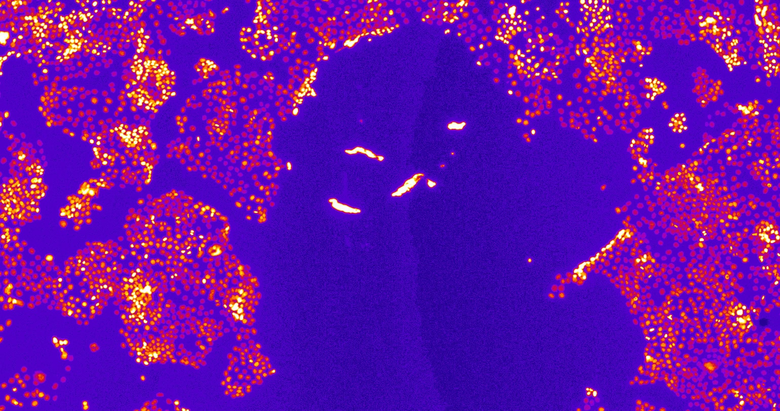 Scratch Assay Zellkultur