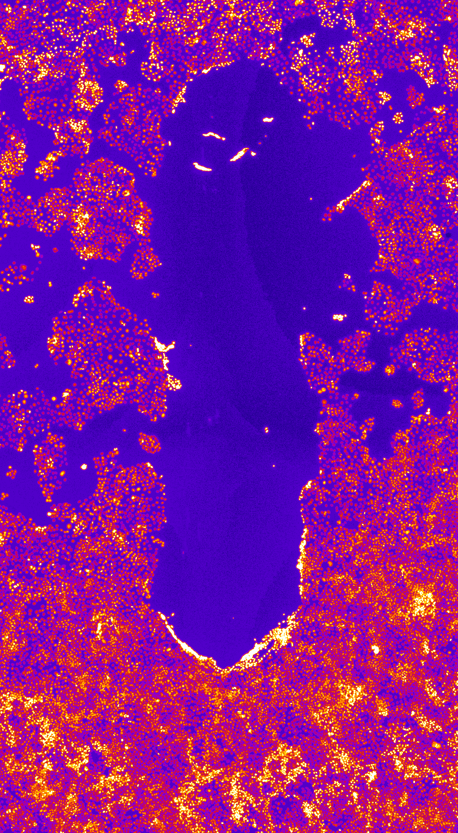 Scratch Assays im MediumThroughput » COREMED