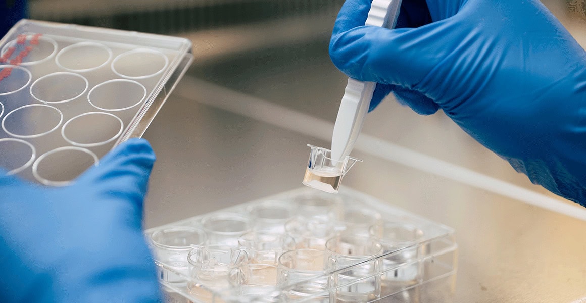 Labor: Organ-on-a-Chip